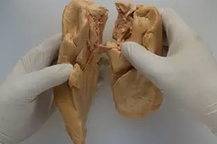 Foie gras en ballotine : Étape 2